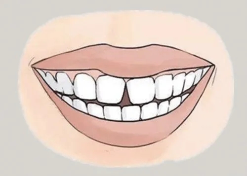 <a href=http://m.nfrzbj.cn/news_article?news_id=116>一次性口腔探針</a>